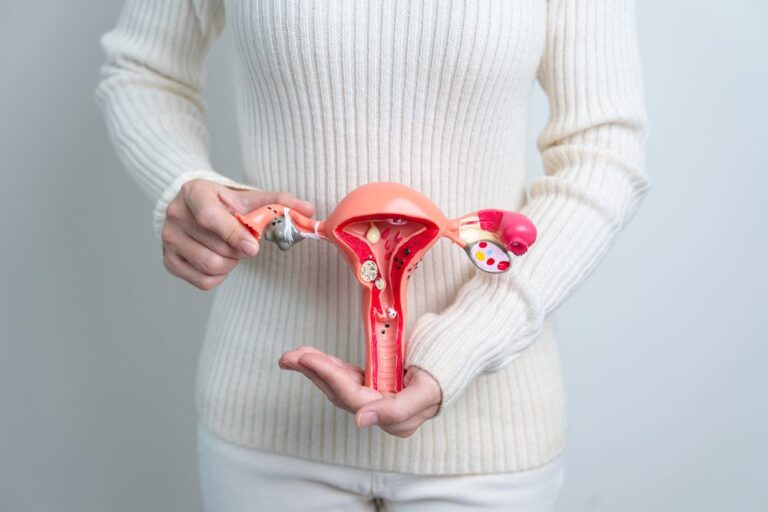 PCOS
