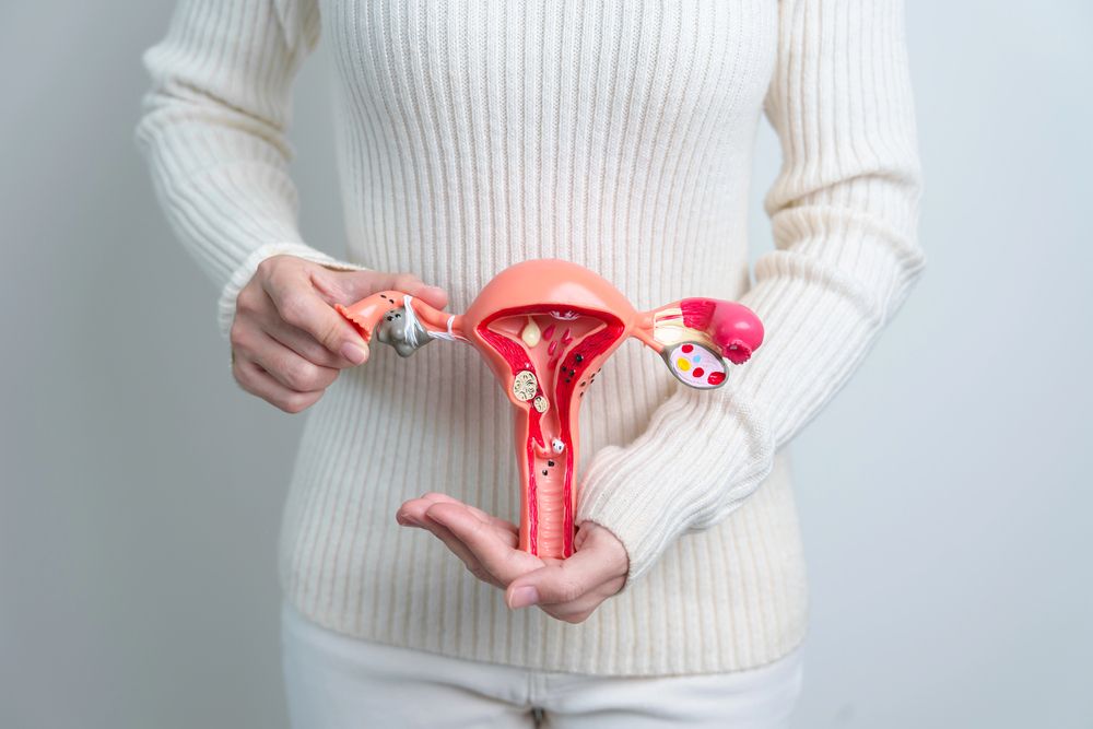 PCOS