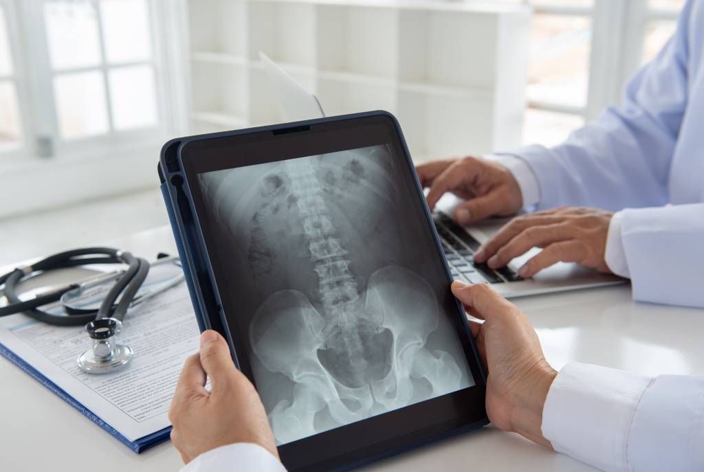 Doctor holding X-ray film